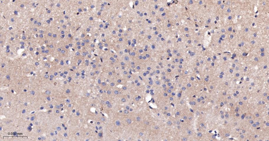 β-连环蛋白/β-连环素/β链接素重组兔单抗