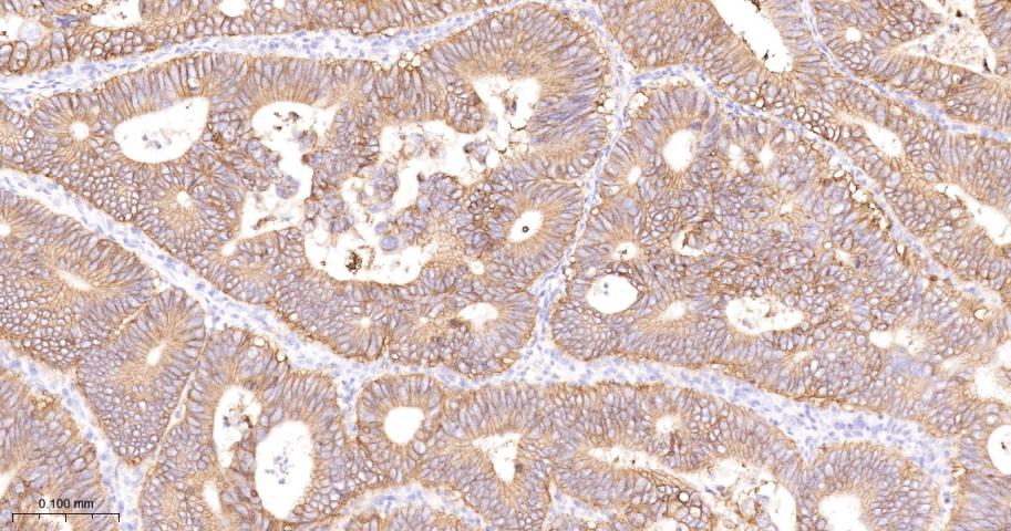 CD46重组兔多克隆抗体