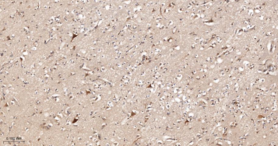 双特异性蛋白磷酸酶6重组兔单抗