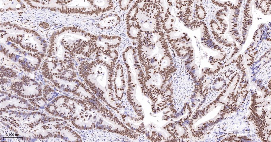 DNA修复酶Ku-80重组兔单抗