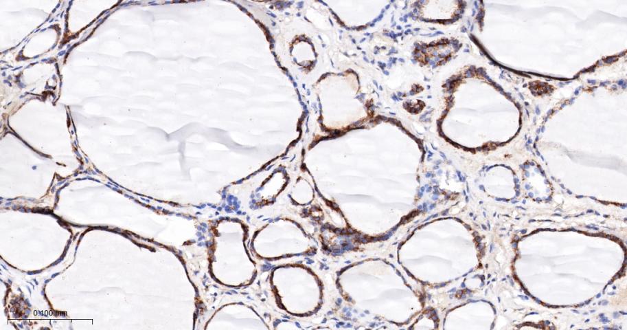 双特异性蛋白磷酸酶6重组兔单抗
