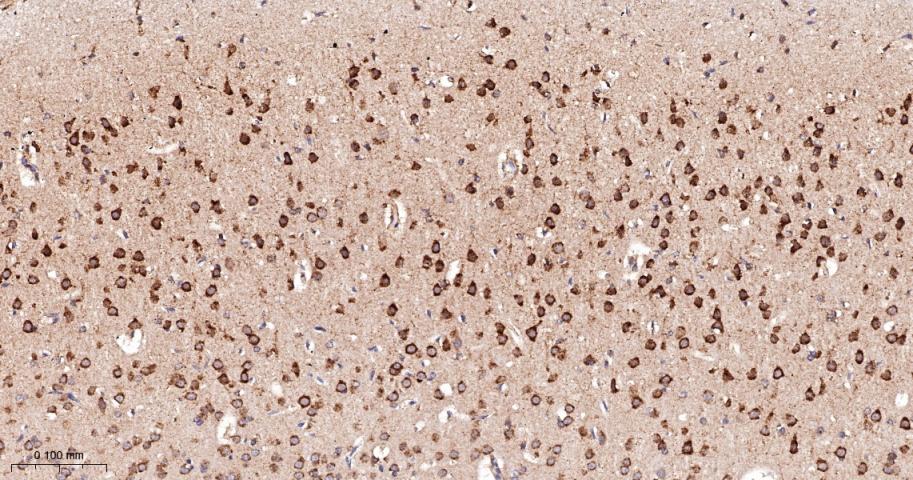 双特异性蛋白磷酸酶6重组兔单抗