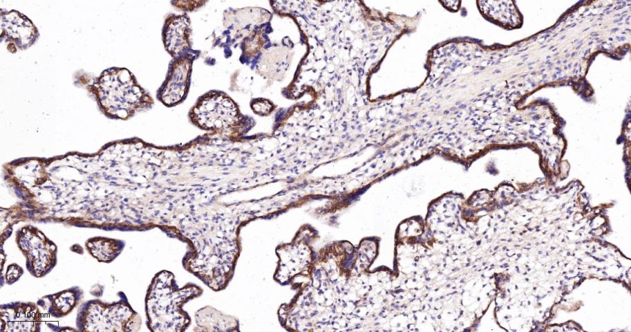 β-连环蛋白/β-连环素/β链接素重组兔单抗