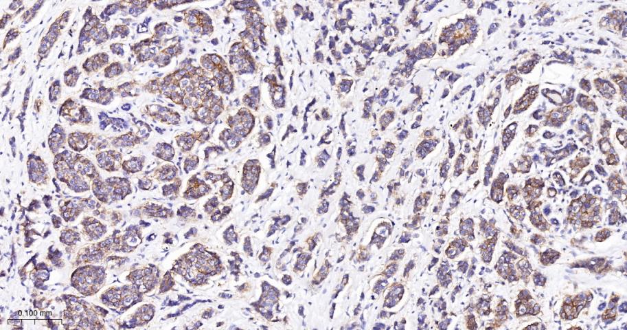 CD46重组兔多克隆抗体