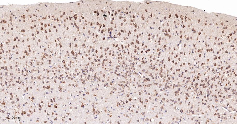双特异性蛋白磷酸酶6重组兔单抗