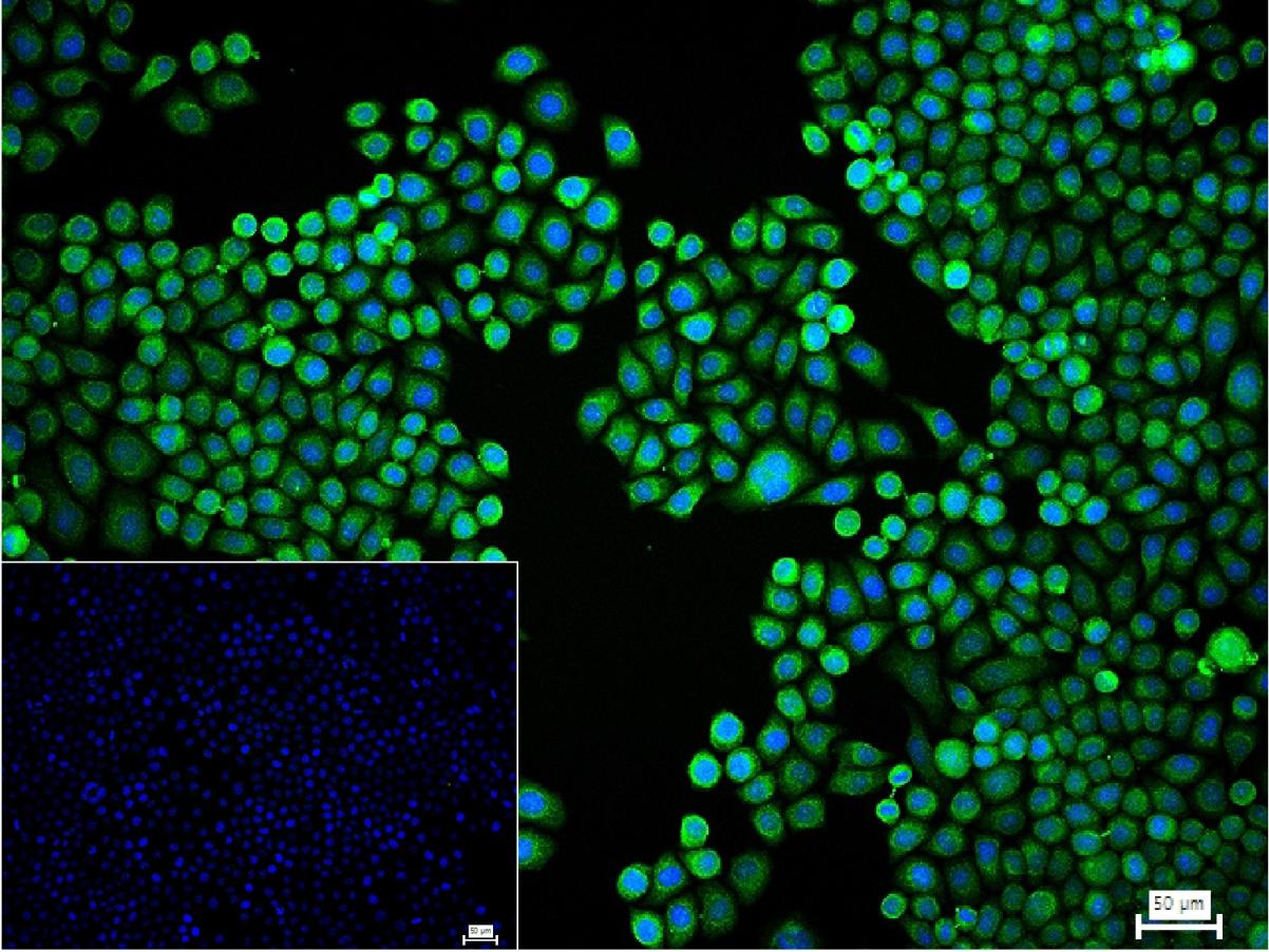 丝裂原活化蛋白激酶1/2单克隆抗体-bsm-33234M