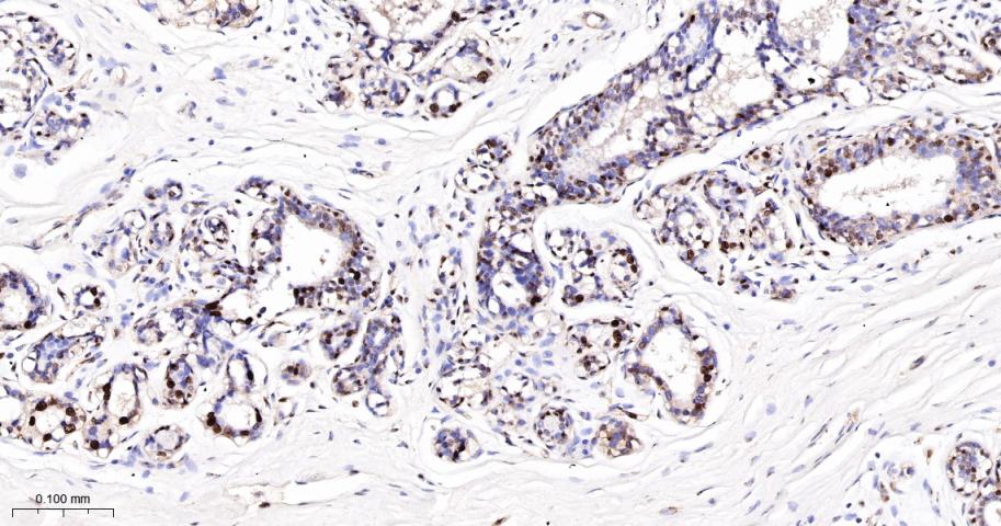 DNA修复酶Ku-80重组兔单抗