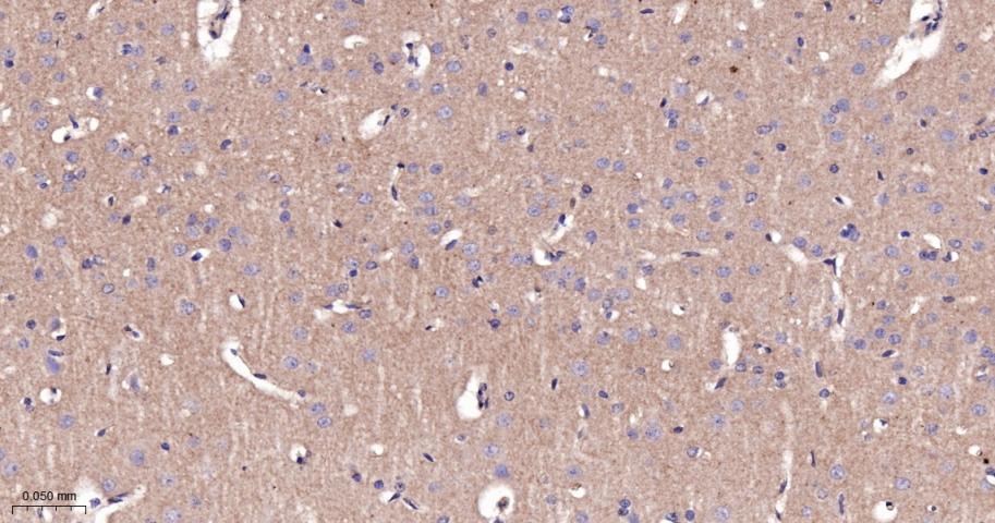 β-连环蛋白/β-连环素/β链接素重组兔单抗