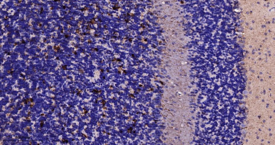 钙结合蛋白重组兔单抗