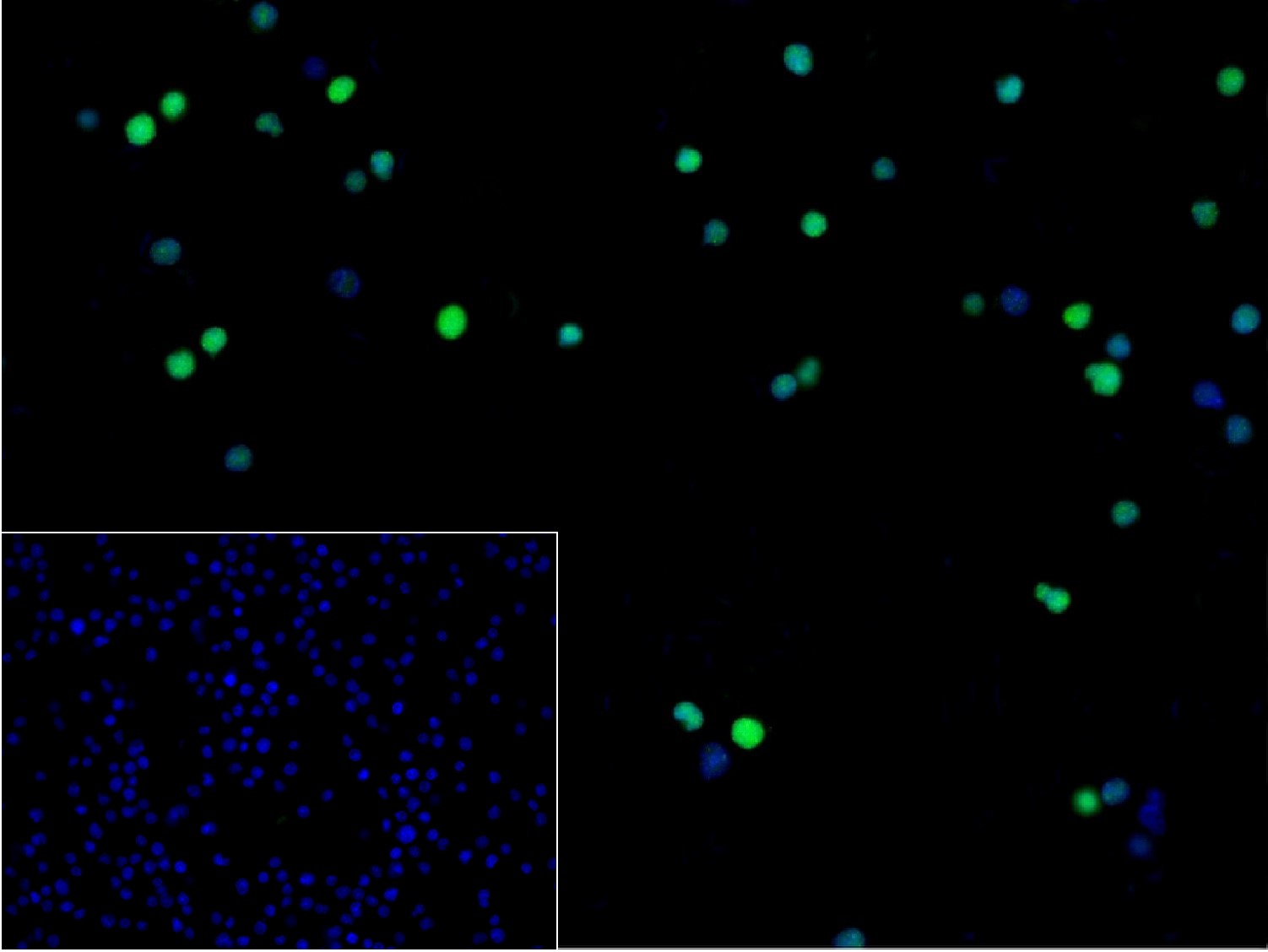 周期素E2重组兔单抗