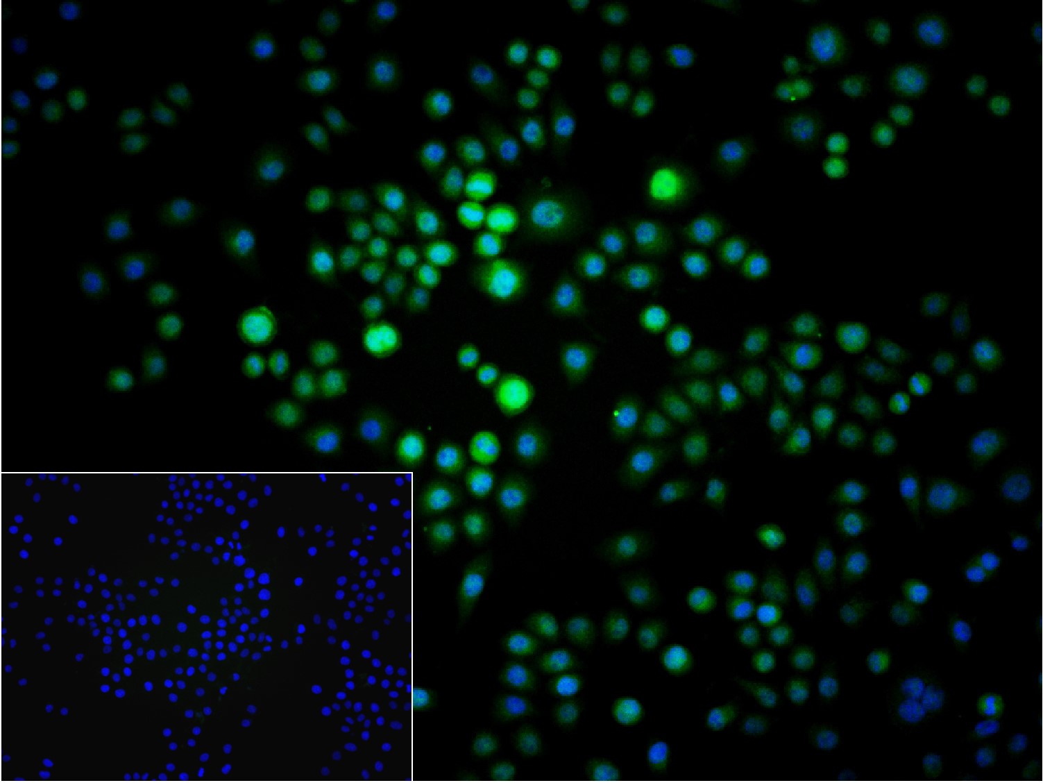 组蛋白去乙酰化酶4重组兔单抗