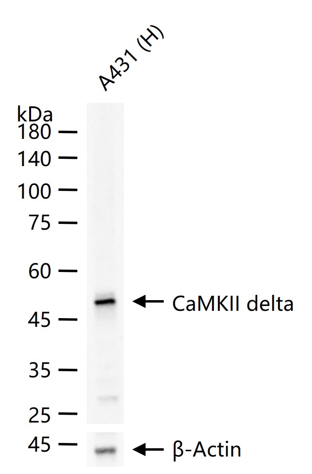 CaMKII delta Recombinant Rabbit mAb (一抗) - WB,IHC-P,IHC-F,IF | Bioss