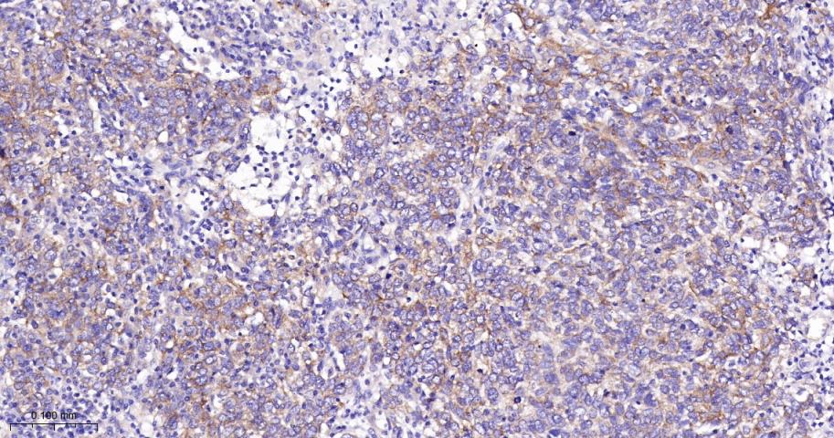 自噬相关蛋白9A重组兔单抗