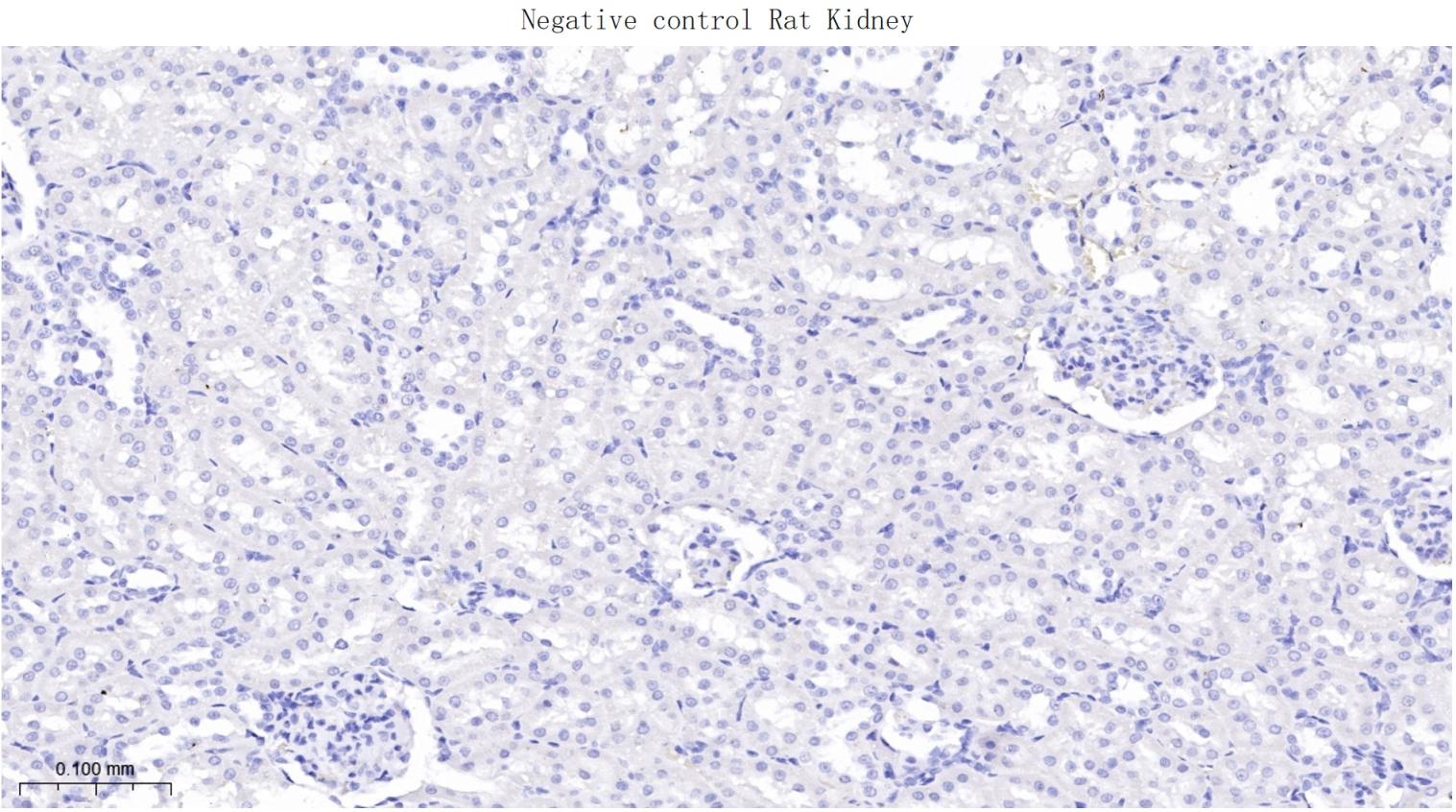 酪氨酸激酶A/B/C重组兔单抗-bsm-52715R
