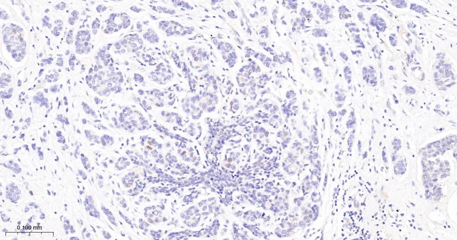 周期素E2重组兔单抗