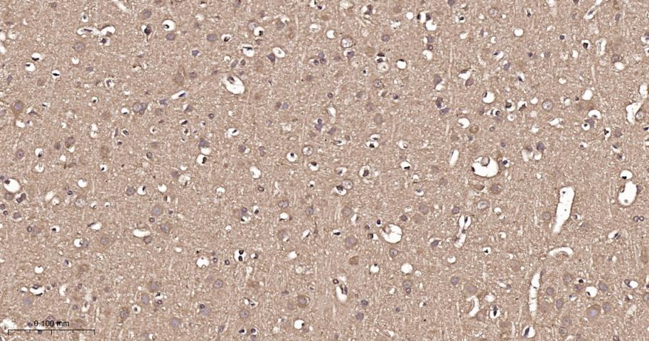 热休克蛋白56重组兔单抗