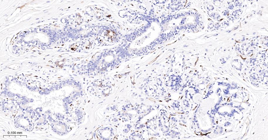 谷氨酰胺转胺酶2重组鼠单抗-bsm-55524M