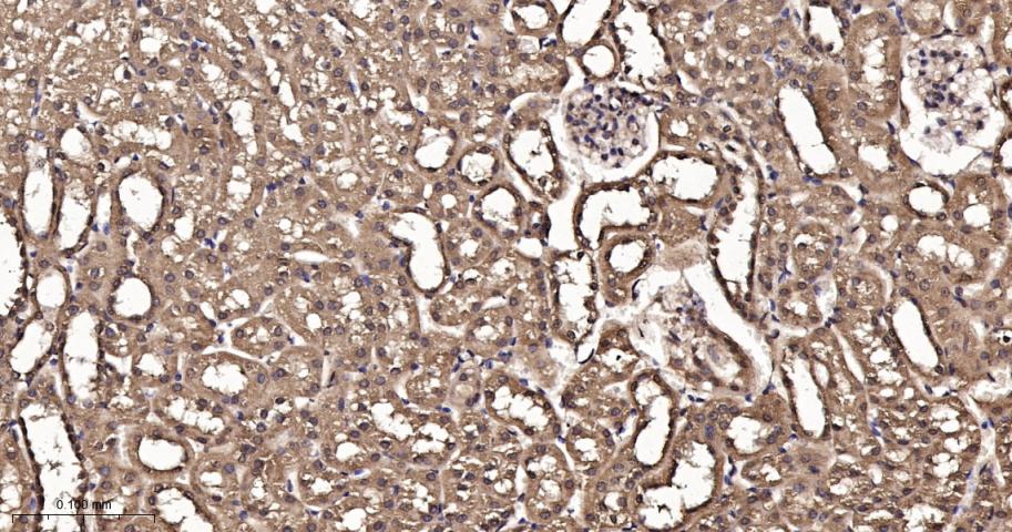 热休克蛋白56重组兔单抗
