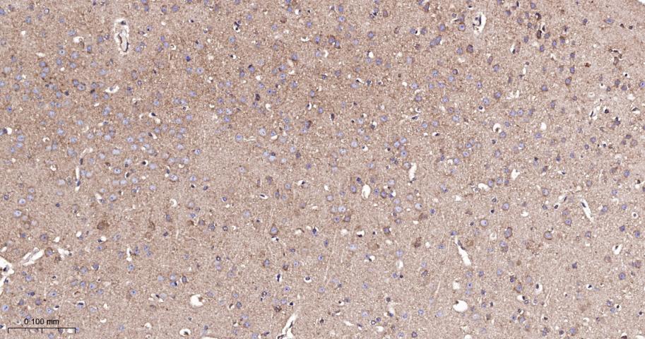 翻译延伸因子EF-1a重组兔单抗