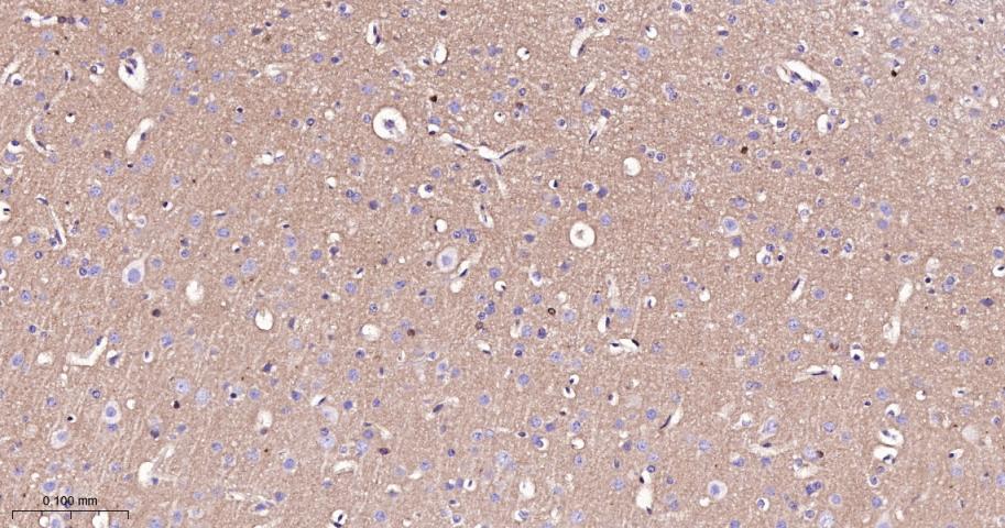 朊病毒蛋白CD230重组兔单抗