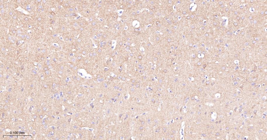 酪氨酸激酶A/B/C重组兔单抗-bsm-52715R