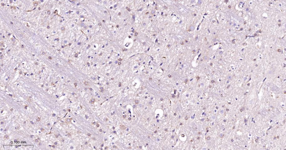自噬相关蛋白9A重组兔单抗