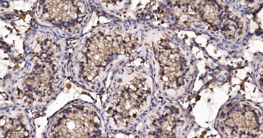 热休克蛋白56重组兔单抗