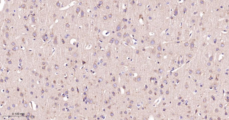 自噬相关蛋白9A重组兔单抗