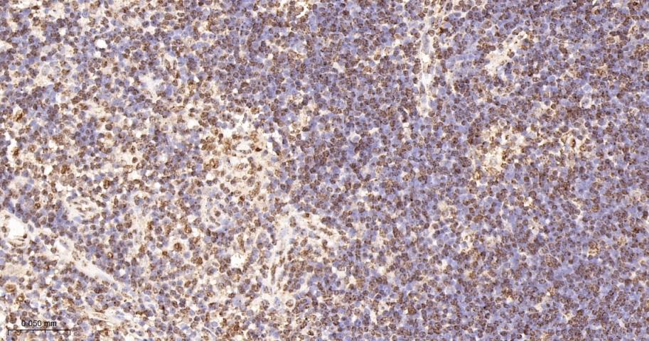 组蛋白H2AZ重组兔单抗