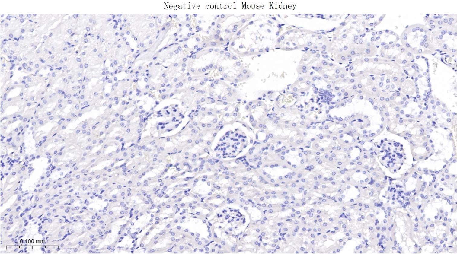 酪氨酸激酶A/B/C重组兔单抗-bsm-52715R