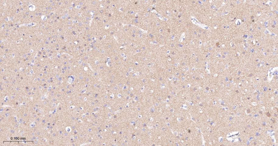 酪氨酸激酶A/B/C重组兔单抗-bsm-52715R