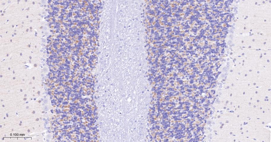 酪氨酸激酶A/B/C重组兔单抗-bsm-52715R