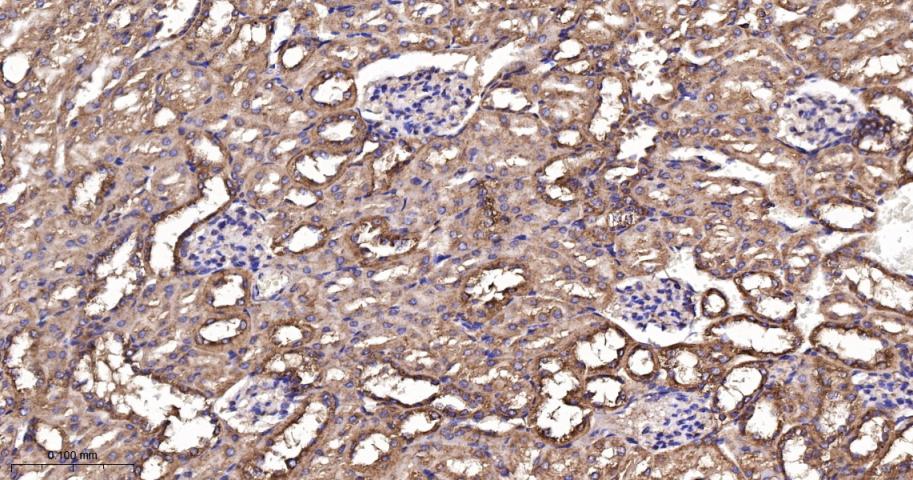 翻译延伸因子EF-1a重组兔单抗