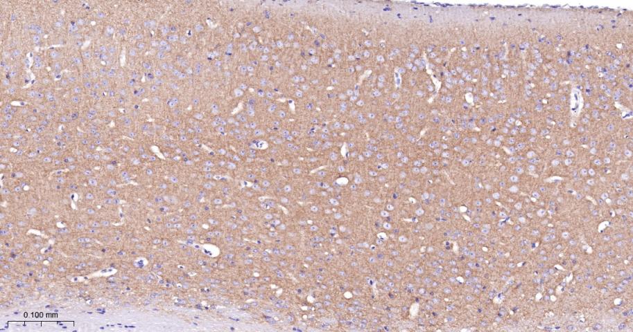 酪氨酸激酶A/B/C重组兔单抗-bsm-52715R