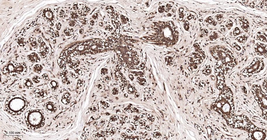热休克蛋白56重组兔单抗