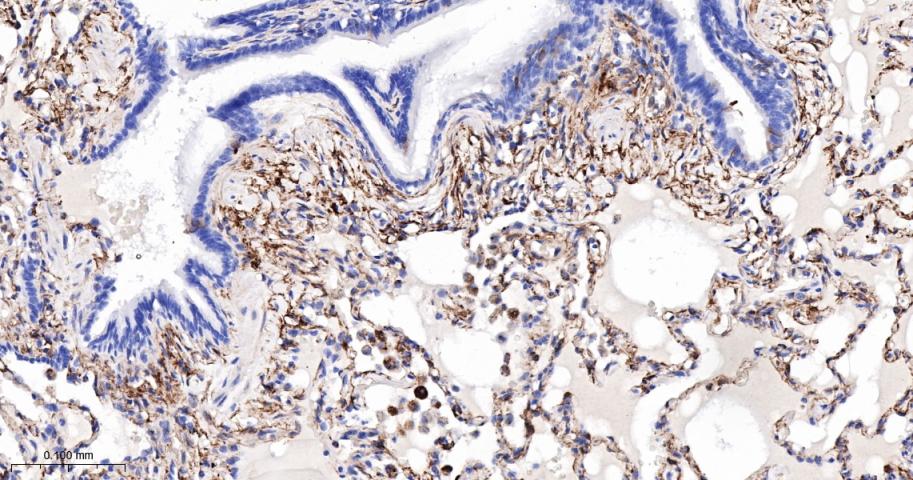 谷氨酰胺转胺酶2重组鼠单抗-bsm-55524M