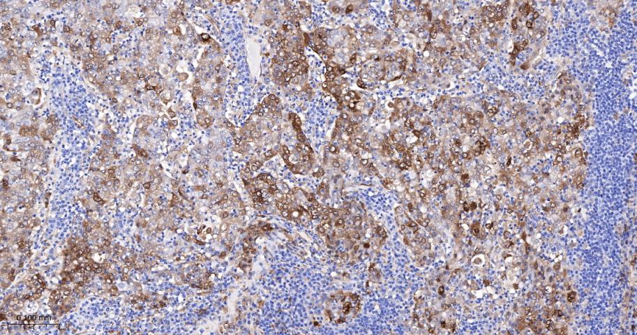 谷氨酰胺转胺酶2重组鼠单抗-bsm-55524M