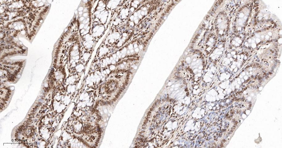 组蛋白H2AZ重组兔单抗