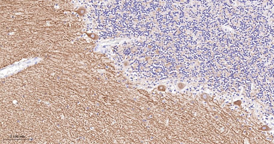 促代谢型谷氨酸受体1重组兔单抗