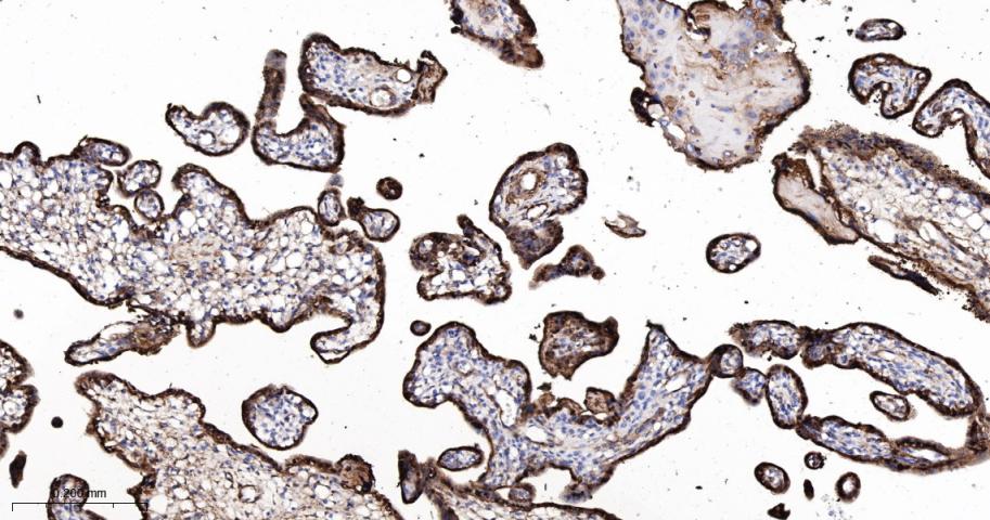 谷氨酰胺转胺酶2重组鼠单抗-bsm-55524M