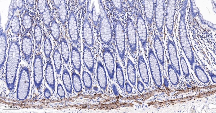 谷氨酰胺转胺酶2重组鼠单抗-bsm-55524M