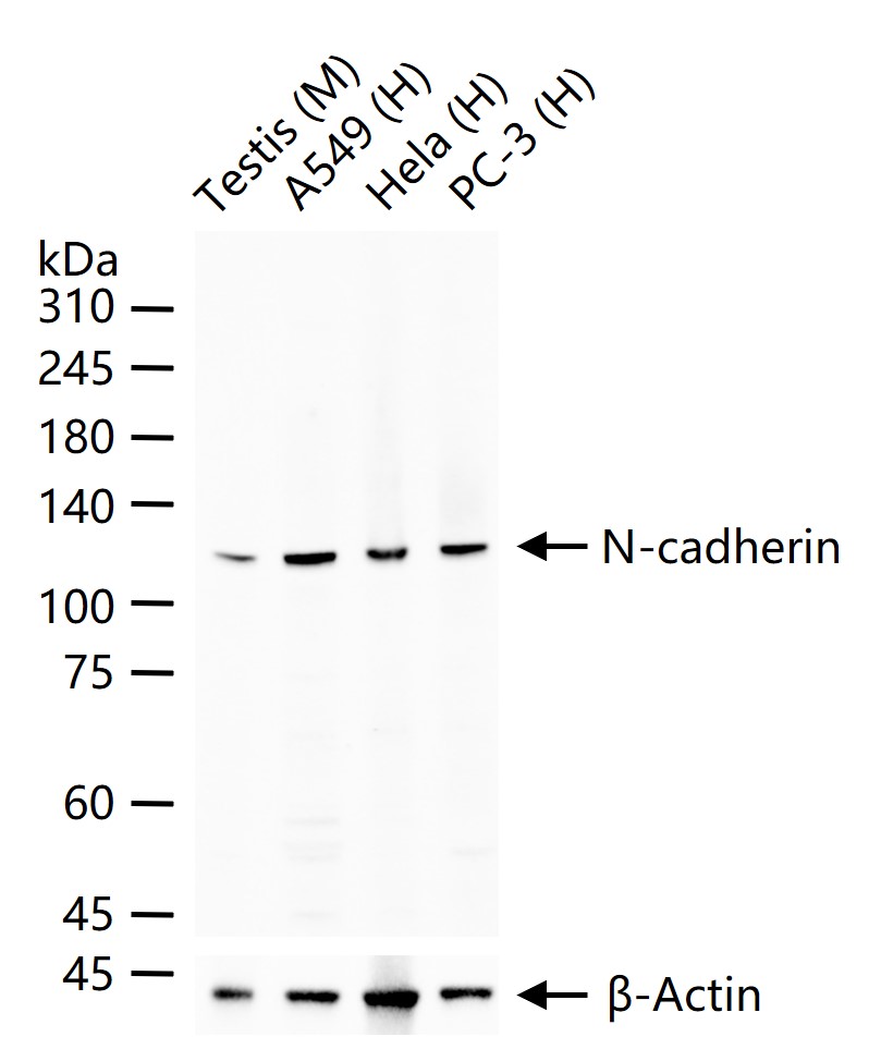 N-cadherin Rabbit pAb (一抗) - WB | Bioss