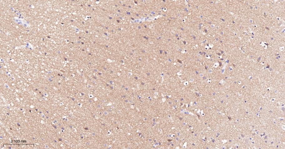 酪氨酸激酶A/B/C重组兔单抗-bsm-52715R