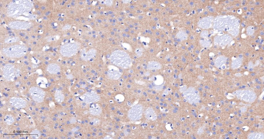 促代谢型谷氨酸受体1重组兔单抗