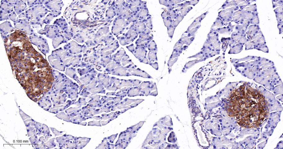 朊病毒蛋白CD230重组兔单抗