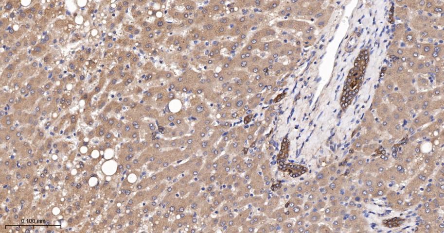 Runx3重组兔单抗