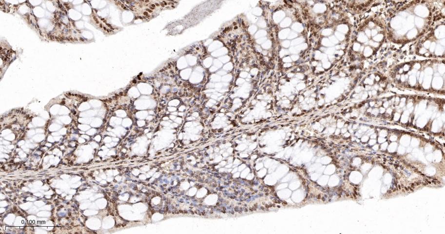 组蛋白H2AZ重组兔单抗