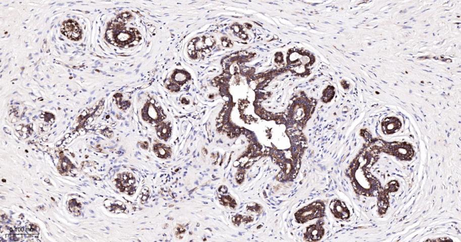 翻译延伸因子EF-1a重组兔单抗