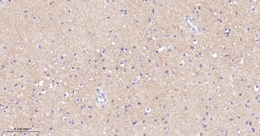 促代谢型谷氨酸受体1重组兔单抗