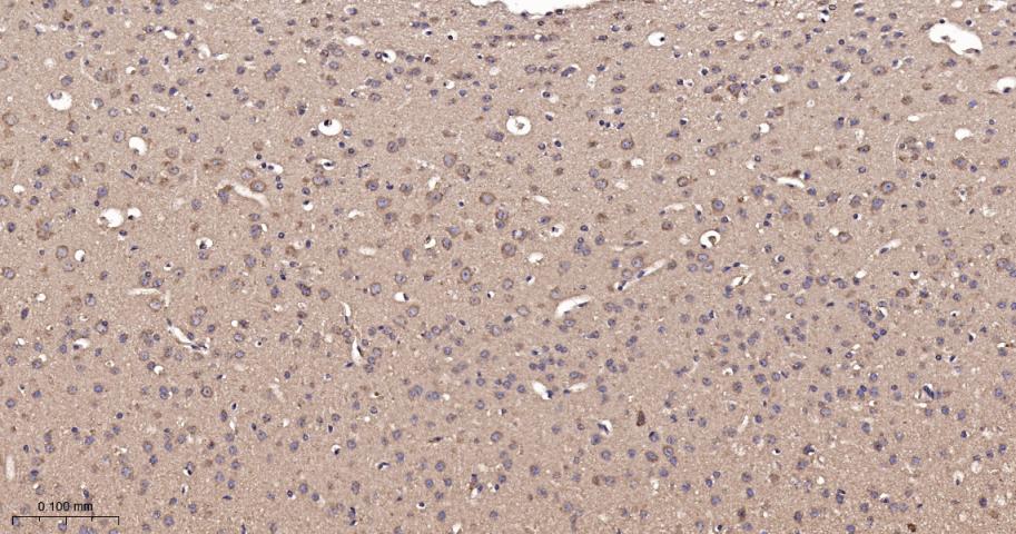 Runx3重组兔单抗